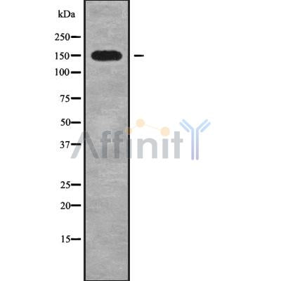 DF9654 at 1/100 staining Mouse colon tissue by IHC-P. The sample was formaldehyde fixed and a heat mediated antigen retrieval step in citrate buffer was performed. The sample was then blocked and incubated with the antibody for 1.5 hours at 22¡ãC. An HRP conjugated goat anti-rabbit antibody was used as the secondary