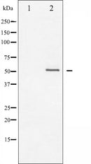 AF3131 at 1/100 staining Human kidney tissue by IHC-P. The sample was formaldehyde fixed and a heat mediated antigen retrieval step in citrate buffer was performed. The sample was then blocked and incubated with the antibody for 1.5 hours at 22¡ãC. An HRP conjugated goat anti-rabbit antibody was used as the secondary