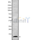 Western blot analysis NDUFA1 using K562 whole cell lysates