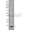 Western blot analysis NDUFB3 using LOVO whole cell lysates