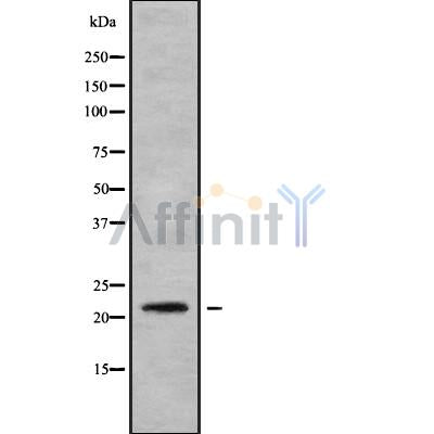Western blot analysis NDUFB8 using HuvEc whole cell lysates