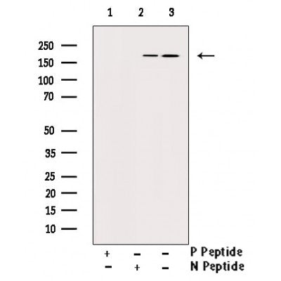 Phospho-PDGFR beta (Tyr740) Antibody for IHC in human testis 