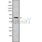 Western blot analysis NDUFS2 using COLO205 whole cell lysates