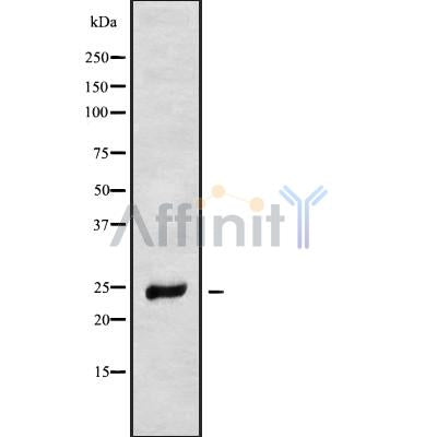 Western blot analysis NDUFS8 using LOVO whole cell lysates