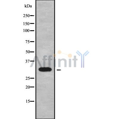 Western blot analysis of extracts from HepG2 and mouse heart, using CYB5R2 Antibody.