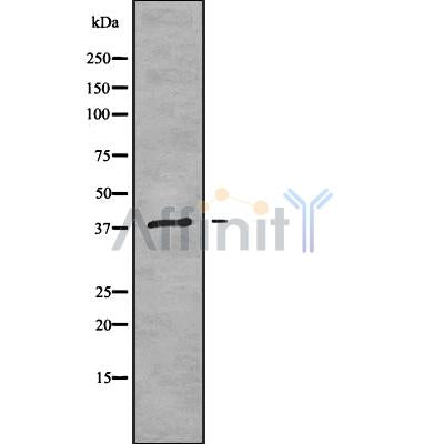 DF9674 at 1/100 staining Mouse kidney tissue by IHC-P. The sample was formaldehyde fixed and a heat mediated antigen retrieval step in citrate buffer was performed. The sample was then blocked and incubated with the antibody for 1.5 hours at 22¡ãC. An HRP conjugated goat anti-rabbit antibody was used as the secondary