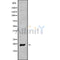 DF9676 at 1/100 staining Mouse kidney tissue by IHC-P. The sample was formaldehyde fixed and a heat mediated antigen retrieval step in citrate buffer was performed. The sample was then blocked and incubated with the antibody for 1.5 hours at 22¡ãC. An HRP conjugated goat anti-rabbit antibody was used as the secondary
