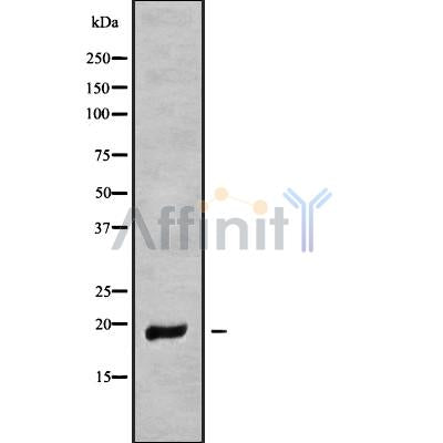 DF9676 at 1/100 staining Mouse kidney tissue by IHC-P. The sample was formaldehyde fixed and a heat mediated antigen retrieval step in citrate buffer was performed. The sample was then blocked and incubated with the antibody for 1.5 hours at 22¡ãC. An HRP conjugated goat anti-rabbit antibody was used as the secondary