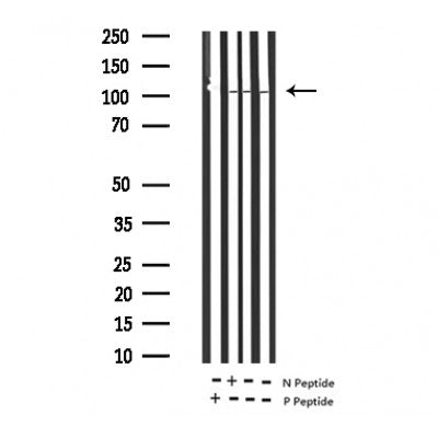 AF3132 at 1/100 staining human Prostate tissue sections by IHC-P. The tissue was formaldehyde fixed and a heat mediated antigen retrieval step in citrate buffer was performed. The tissue was then blocked and incubated with the antibody for 1.5 hours at 22¡ãC. An HRP conjugated goat anti-rabbit antibody was used as the secondary