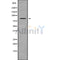 Western blot analysis NPHP1 using HepG2 whole cell lysates