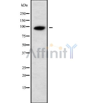 DF9679 at 1/100 staining Human liver cancer tissue by IHC-P. The sample was formaldehyde fixed and a heat mediated antigen retrieval step in citrate buffer was performed. The sample was then blocked and incubated with the antibody for 1.5 hours at 22¡ãC. An HRP conjugated goat anti-rabbit antibody was used as the secondary