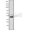 DF9680 at 1/100 staining Human gastric tissue by IHC-P. The sample was formaldehyde fixed and a heat mediated antigen retrieval step in citrate buffer was performed. The sample was then blocked and incubated with the antibody for 1.5 hours at 22¡ãC. An HRP conjugated goat anti-rabbit antibody was used as the secondary