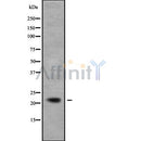 Western blot analysis NCALD using COS7 whole cell lysates