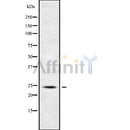 DF9688 at 1/100 staining Mouse kidney tissue by IHC-P. The sample was formaldehyde fixed and a heat mediated antigen retrieval step in citrate buffer was performed. The sample was then blocked and incubated with the antibody for 1.5 hours at 22¡ãC. An HRP conjugated goat anti-rabbit antibody was used as the secondary