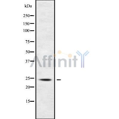 DF9688 at 1/100 staining Mouse kidney tissue by IHC-P. The sample was formaldehyde fixed and a heat mediated antigen retrieval step in citrate buffer was performed. The sample was then blocked and incubated with the antibody for 1.5 hours at 22¡ãC. An HRP conjugated goat anti-rabbit antibody was used as the secondary