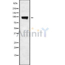 Western blot analysis of extracts from HepG2, using NLGN3 Antibody. Lane 1 was treated with the blocking peptide.