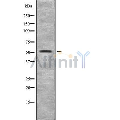 DF9697 at 1/100 staining Human liver cancer tissue by IHC-P. The sample was formaldehyde fixed and a heat mediated antigen retrieval step in citrate buffer was performed. The sample was then blocked and incubated with the antibody for 1.5 hours at 22¡ãC. An HRP conjugated goat anti-rabbit antibody was used as the secondary