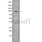 Western blot analysis NPAS2 using Jurkat whole cell lysates