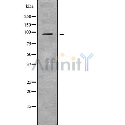 Western blot analysis NPAS2 using Jurkat whole cell lysates