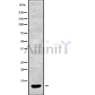 DF9702 at 1/100 staining Mouse kidney tissue by IHC-P. The sample was formaldehyde fixed and a heat mediated antigen retrieval step in citrate buffer was performed. The sample was then blocked and incubated with the antibody for 1.5 hours at 22¡ãC. An HRP conjugated goat anti-rabbit antibody was used as the secondary
