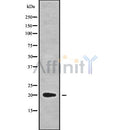 DF9703 at 1/100 staining Mouse kidney tissue by IHC-P. The sample was formaldehyde fixed and a heat mediated antigen retrieval step in citrate buffer was performed. The sample was then blocked and incubated with the antibody for 1.5 hours at 22¡ãC. An HRP conjugated goat anti-rabbit antibody was used as the secondary