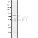 DF9705 staining HepG2 by IF/ICC. The sample were fixed with PFA and permeabilized in 0.1% Triton X-100,then blocked in 10% serum for 45 minutes at 25¡ãC. The primary antibody was diluted at 1/200 and incubated with the sample for 1 hour at 37¡ãC. An  Alexa Fluor 594 conjugated goat anti-rabbit IgG (H+L) Ab, diluted at 1/600, was used as the secondary antibod