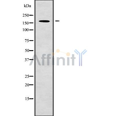 Western blot analysis NUP153 using COLO205 whole cell lysates