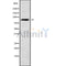 DF9711 at 1/100 staining Mouse liver tissue by IHC-P. The sample was formaldehyde fixed and a heat mediated antigen retrieval step in citrate buffer was performed. The sample was then blocked and incubated with the antibody for 1.5 hours at 22¡ãC. An HRP conjugated goat anti-rabbit antibody was used as the secondary