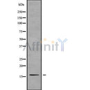 Western blot analysis of TNP2 using A549 whole cell lysates