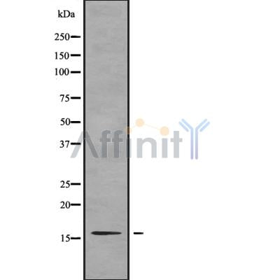 Western blot analysis of TNP2 using A549 whole cell lysates