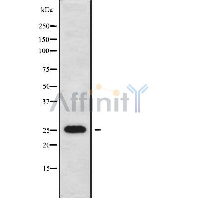 Western blot analysis of extracts from mouse brain, using NOL12 Antibody.