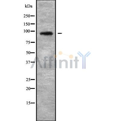 Western blot analysis NOL14 using Jurkat whole cell lysates