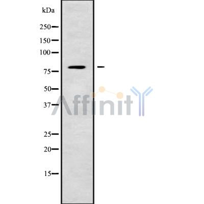 DF9721 at 1/100 staining Human gastric tissue by IHC-P. The sample was formaldehyde fixed and a heat mediated antigen retrieval step in citrate buffer was performed. The sample was then blocked and incubated with the antibody for 1.5 hours at 22¡ãC. An HRP conjugated goat anti-rabbit antibody was used as the secondary