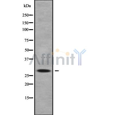 DF9722 at 1/100 staining Rat lung tissue by IHC-P. The sample was formaldehyde fixed and a heat mediated antigen retrieval step in citrate buffer was performed. The sample was then blocked and incubated with the antibody for 1.5 hours at 22¡ãC. An HRP conjugated goat anti-rabbit antibody was used as the secondary