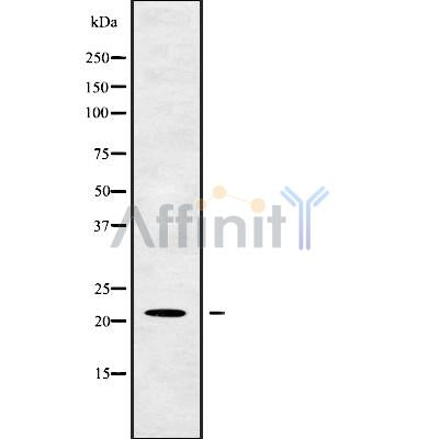 DF9725 at 1/100 staining Rat liver tissue by IHC-P. The sample was formaldehyde fixed and a heat mediated antigen retrieval step in citrate buffer was performed. The sample was then blocked and incubated with the antibody for 1.5 hours at 22¡ãC. An HRP conjugated goat anti-rabbit antibody was used as the secondary