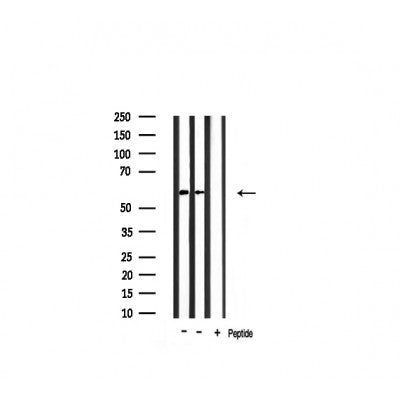 Western blot analysis of extracts of various tissue ,using Keratin 10 antibody.