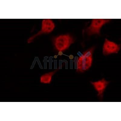 AF0197 staining HeLa by IF/ICC. The sample were fixed with PFA and permeabilized in 0.1% Triton X-100,then blocked in 10% serum for 45 minutes at 25¡ãC. The primary antibody was diluted at 1/200 and incubated with the sample for 1 hour at 37¡ãC. An  Alexa Fluor 594 conjugated goat anti-rabbit IgG (H+L) Ab, diluted at 1/600, was used as the secondary antibod