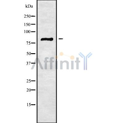 Western blot analysis of extracts from rat brain, using SLC6A17 Antibody.