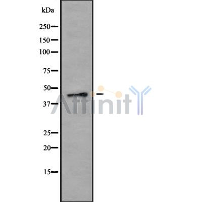 Western blot analysis of P2RX1 using K562 whole cell lysates