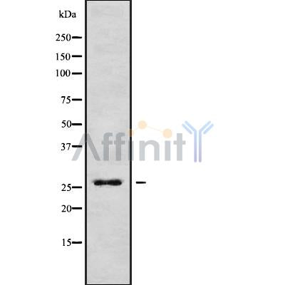 DF9729 at 1/100 staining Rat heart tissue by IHC-P. The sample was formaldehyde fixed and a heat mediated antigen retrieval step in citrate buffer was performed. The sample was then blocked and incubated with the antibody for 1.5 hours at 22¡ãC. An HRP conjugated goat anti-rabbit antibody was used as the secondary