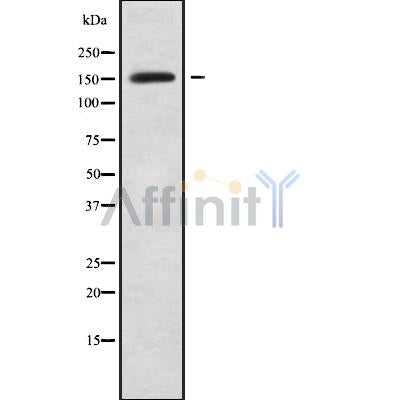 Western blot analysis of PALLD using HepG2 whole cell lysates