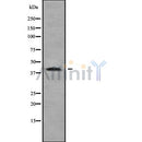 Western blot analysis of extracts from HUVEC, using ZDHHC18 Antibody. Lane 1 was treated with the blocking peptide.