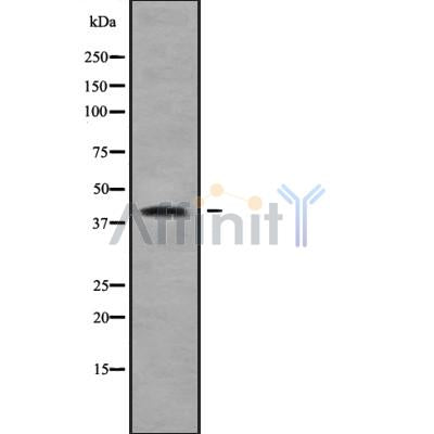 Western blot analysis of extracts from HUVEC, using ZDHHC18 Antibody. Lane 1 was treated with the blocking peptide.