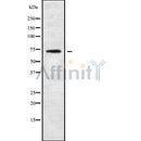 DF9733 staining HepG2 by IF/ICC. The sample were fixed with PFA and permeabilized in 0.1% Triton X-100,then blocked in 10% serum for 45 minutes at 25¡ãC. The primary antibody was diluted at 1/200 and incubated with the sample for 1 hour at 37¡ãC. An  Alexa Fluor 594 conjugated goat anti-rabbit IgG (H+L) Ab, diluted at 1/600, was used as the secondary antibod