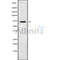 DF9733 staining HepG2 by IF/ICC. The sample were fixed with PFA and permeabilized in 0.1% Triton X-100,then blocked in 10% serum for 45 minutes at 25¡ãC. The primary antibody was diluted at 1/200 and incubated with the sample for 1 hour at 37¡ãC. An  Alexa Fluor 594 conjugated goat anti-rabbit IgG (H+L) Ab, diluted at 1/600, was used as the secondary antibod