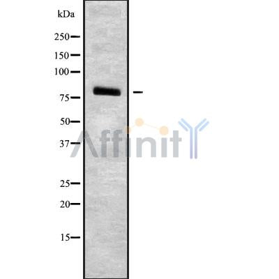 Western blot analysis of HSD17B4 using K562 whole cell lysates