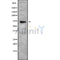 DF9736 staining Hela by IF/ICC. The sample were fixed with PFA and permeabilized in 0.1% Triton X-100,then blocked in 10% serum for 45 minutes at 25¡ãC. The primary antibody was diluted at 1/200 and incubated with the sample for 1 hour at 37¡ãC. An  Alexa Fluor 594 conjugated goat anti-rabbit IgG (H+L) Ab, diluted at 1/600, was used as the secondary antibod