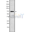 DF9737 staining Hela cells by IF/ICC. The sample were fixed with PFA and permeabilized in 0.1% Triton X-100,then blocked in 10% serum for 45 minutes at 25¡ãC. The primary antibody was diluted at 1/200 and incubated with the sample for 1 hour at 37¡ãC. An  Alexa Fluor 594 conjugated goat anti-rabbit IgG (H+L) antibody(Cat.