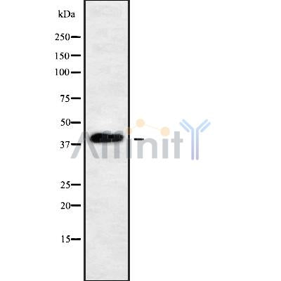 DF9739 at 1/100 staining Mouse kidney tissue by IHC-P. The sample was formaldehyde fixed and a heat mediated antigen retrieval step in citrate buffer was performed. The sample was then blocked and incubated with the antibody for 1.5 hours at 22¡ãC. An HRP conjugated goat anti-rabbit antibody was used as the secondary
