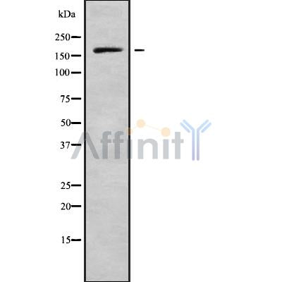 DF9740 at 1/100 staining Mouse brain tissue by IHC-P. The sample was formaldehyde fixed and a heat mediated antigen retrieval step in citrate buffer was performed. The sample was then blocked and incubated with the antibody for 1.5 hours at 22¡ãC. An HRP conjugated goat anti-rabbit antibody was used as the secondary